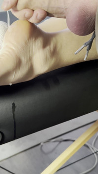 The Lollipop Couldn’t Handle the Pressure