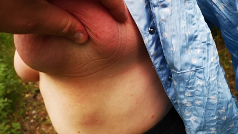 Bouncy Tits Action: Gebonden tieten buitenshuis
