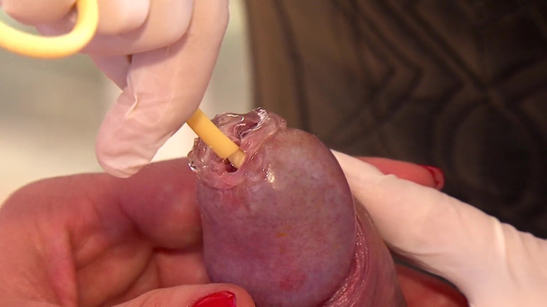 Videos Medical y Sado: दब्बू आदमी और दब्बू लड़की