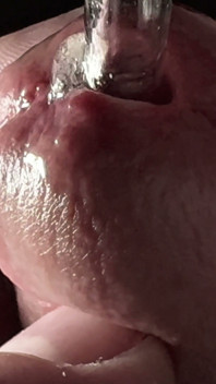 Masturbation