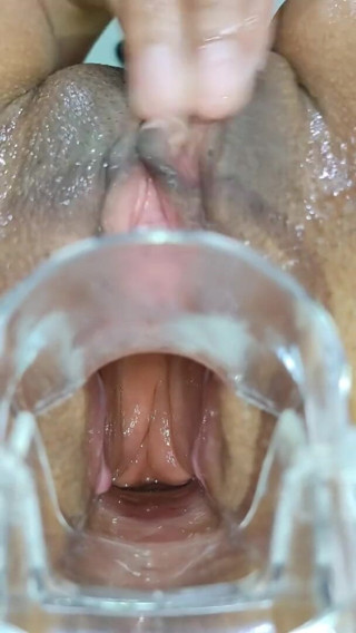 Xamy_97: Expansão anal com espéculo