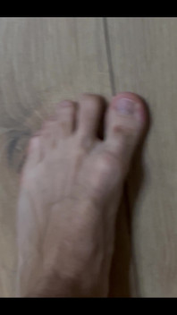 Nohy!