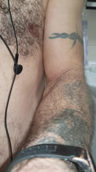 Hairy Body