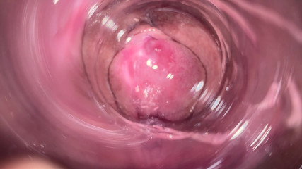 Mia Foster: Kamera di dalam memekku yang sempit, tampilan internal vaginaku yang...