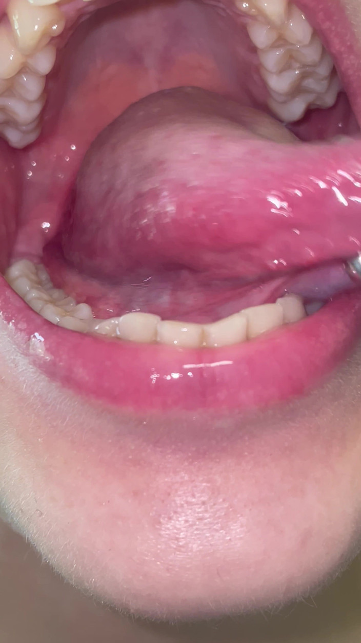 Glitterqueen1999: Mondtour geen make-up tanden tong uvula amandelen controleren