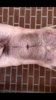 hairy boy 