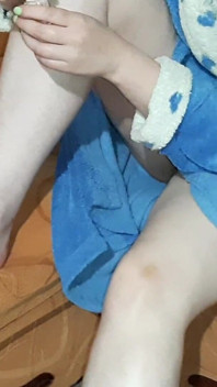 Випадковий спалах пизди мачухи