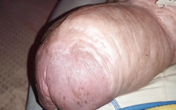 Monster_Meat_: 2liter glucose 'halfeway' of my double injection