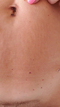 My Body