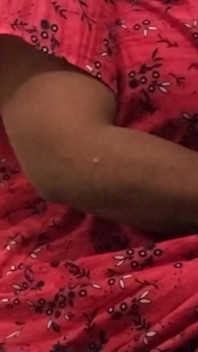 Hot Leg