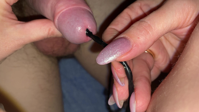 Hairy couple: Buat pertama kalinya, siasatan urogenital dimasukkan ke dalam zakar, lelaki...