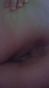 Showing My Asshole