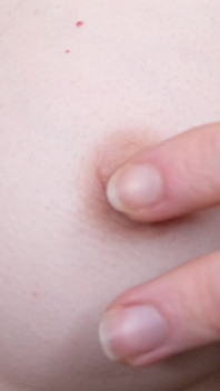 My Nipples