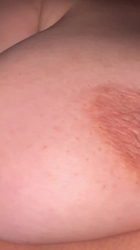 Nipple Montage