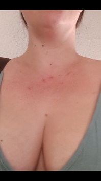 Bouncing My Way up the Stairs