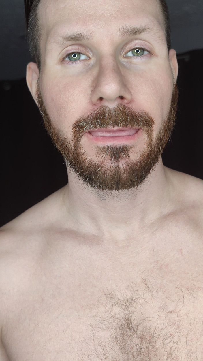 Albino Adonis: Bienvenido