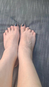 Do We See How Beguiled My Throbbing Foot Veins Are