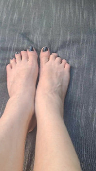 Do We See How Beguiled My Throbbing Foot Veins Are