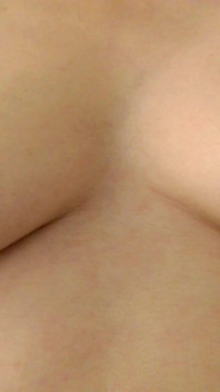 Tepels Close-up