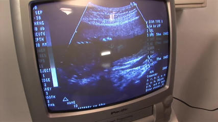 THAGSON: Velmi sexy pregnant_scene 03