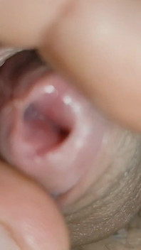 Amazing Glans with Two Cum Holes.