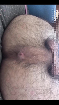 My Asshole in Close-up