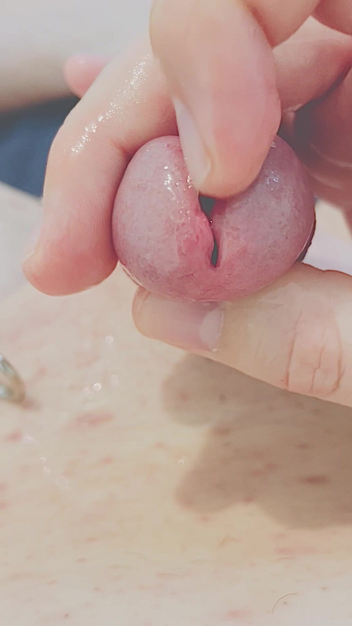 Solodu35x: Handjob dan pelebaran uretra