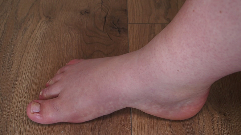 Anastasia Gree: Breda fötter dyrkar: storlek 40 nakenhet - förlorarens uppmärksamhet!