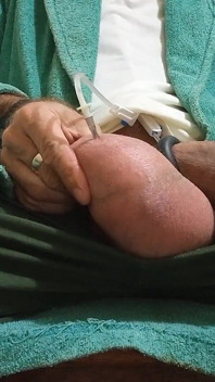 Saline in the Testicles