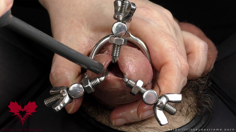 Close Up Extreme: Dilatazione del foro glande espanso e blocco degli spermatozoi mediante...