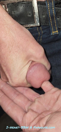 Gaping Urethra - Marker and Pinky Insertion
