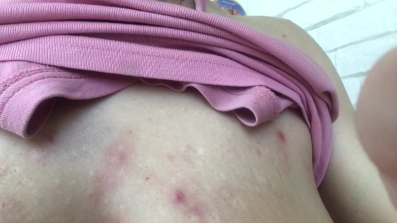 Risky Hairy Couple: Cómo cuidan mis tetas después de jugar bdsm