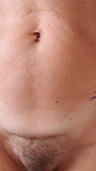 My Body