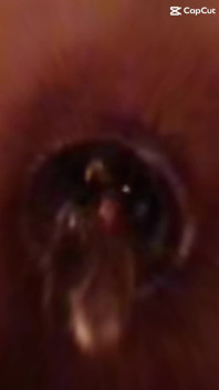Deep Inside My Guts