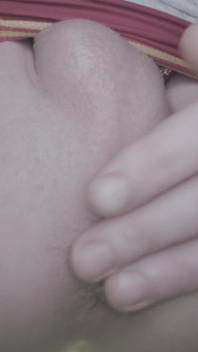 It Hurts, but I Still Need It