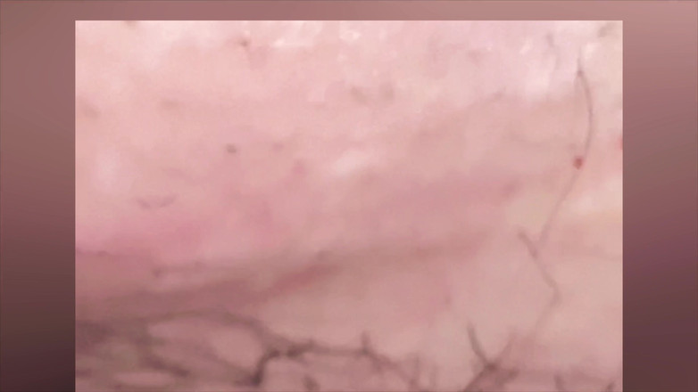 SatisfyingDillyDally: się