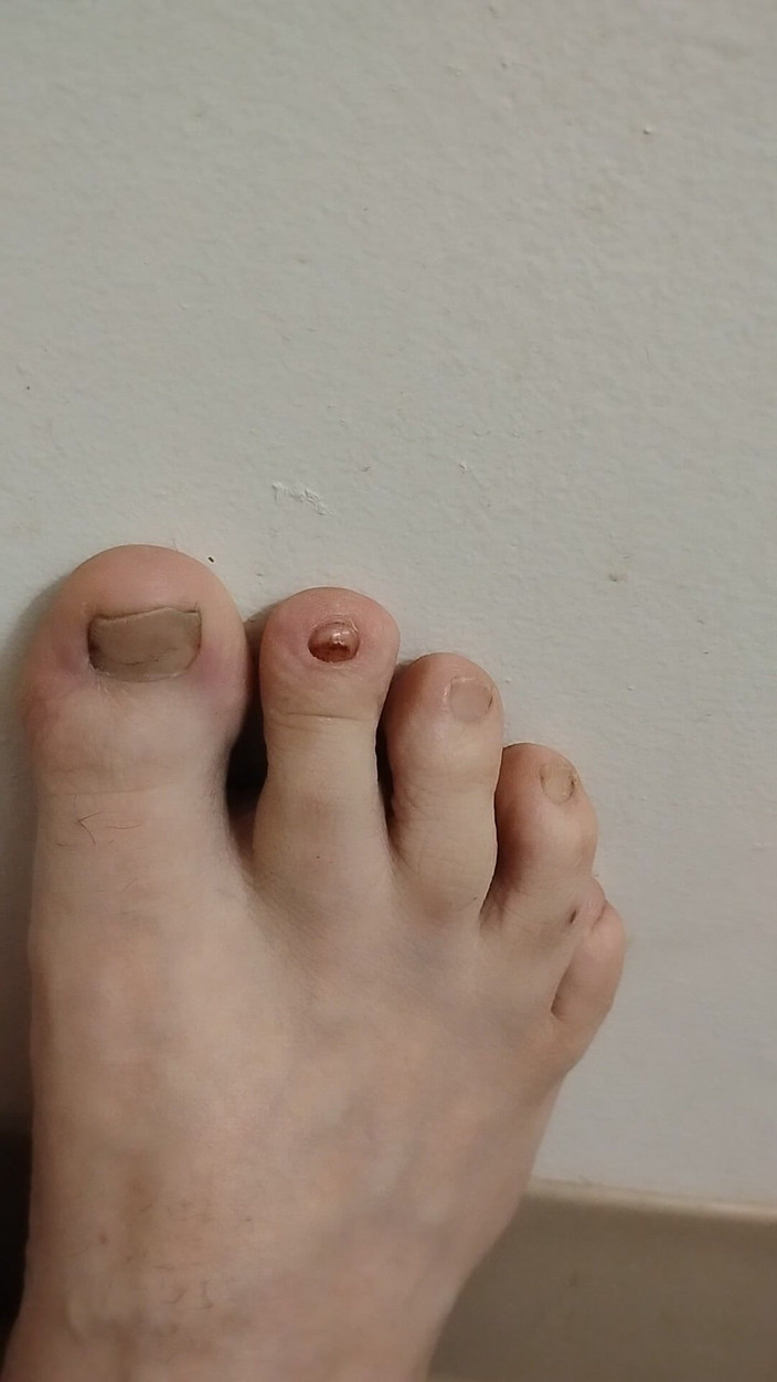 JG Risk: 11-26-2025 Kaki Kecil Imut