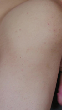 Связывание и растяжка