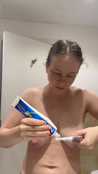 Teen with Braces Brushes Her Teeth