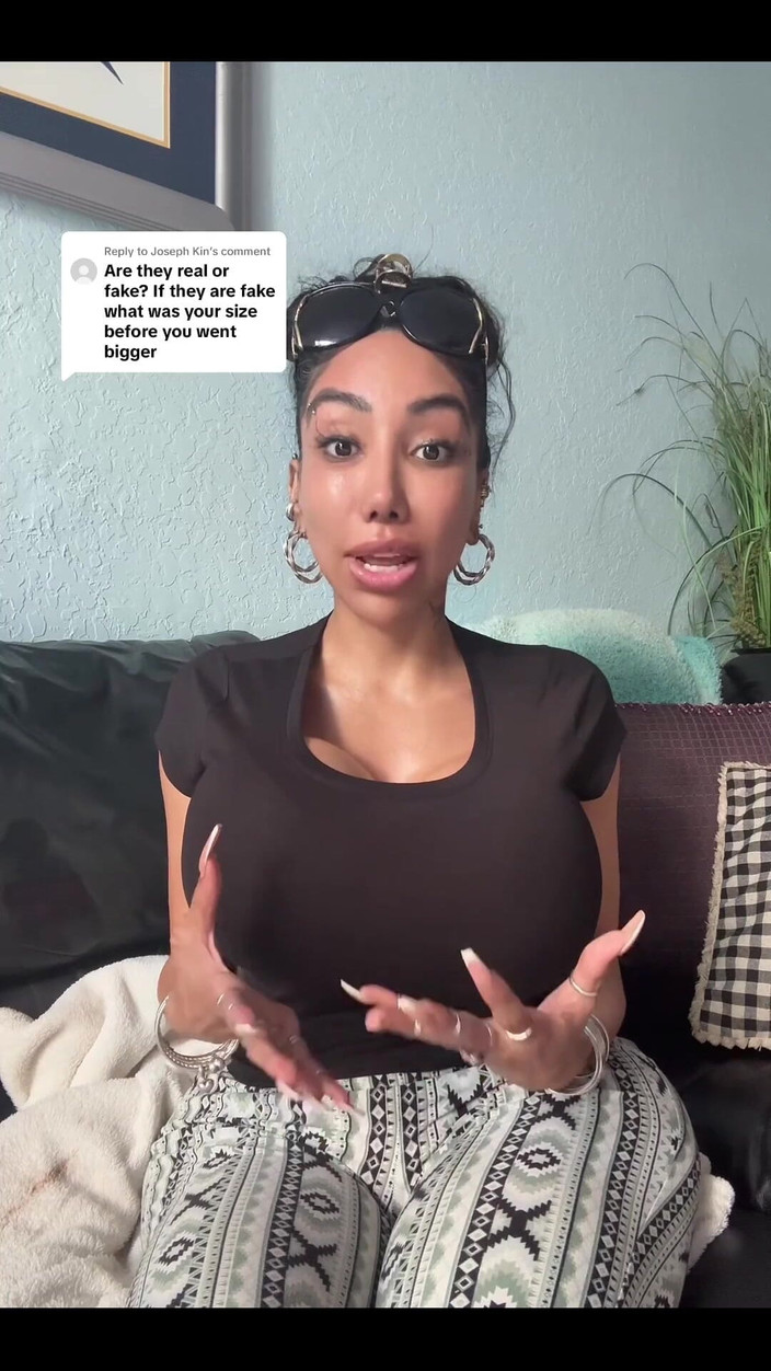 Anakaliyah: Just Wanna Share Some of My Plastic Surgery