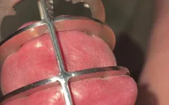 Cepillo de botella en uretra