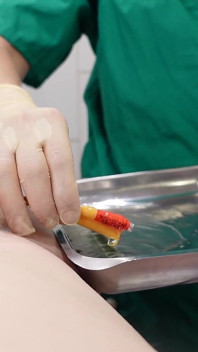 Medfet katétr hra, honění a vnucen orgasmus s vibrátorem
