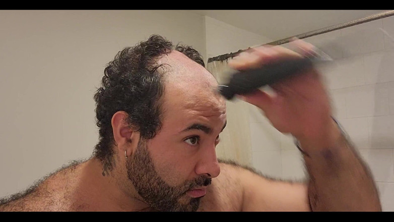 Lobo: I Finally Got Rid of the Head Hair