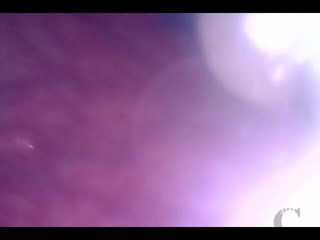 Lina Free: Míčový řetěz mizí hluboko v její díře