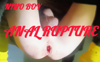 Culopeke: 彼はもう少しで彼女の甘いお尻に手を入れることができました