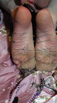 Feetflap