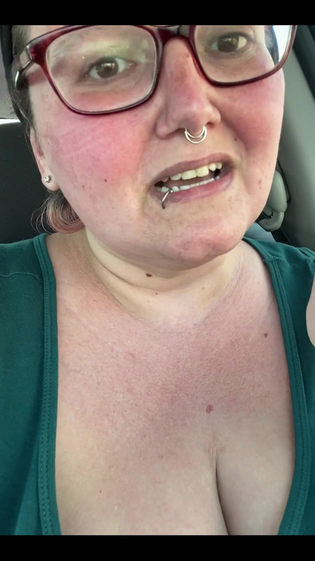 Got a Sunburn for Art Supplies! (Sara Star)