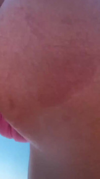 My Ass