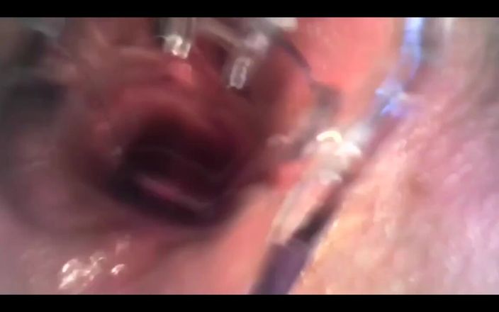 CyntiaCymes: Chơi với Speculum và xem bên trong âm hộ của tôi...