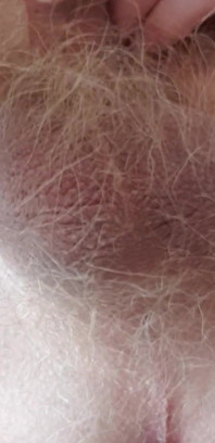 Very Small Cock